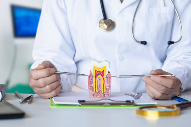 Best Knocked-Out Tooth (Avulsed Tooth) Treatment in Fest Grove, OR